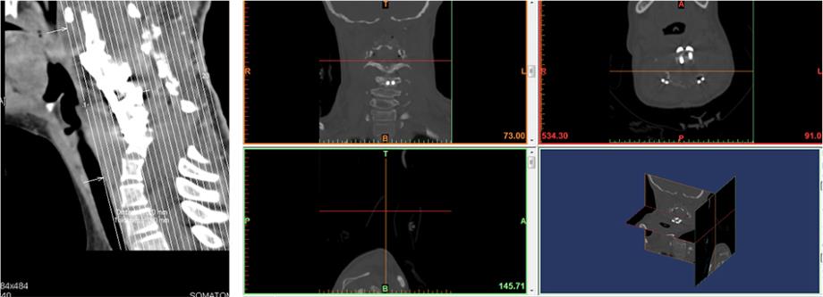 3D model in medical industry